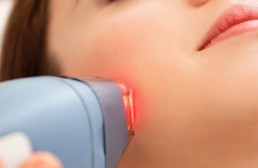 depilacja laserowa